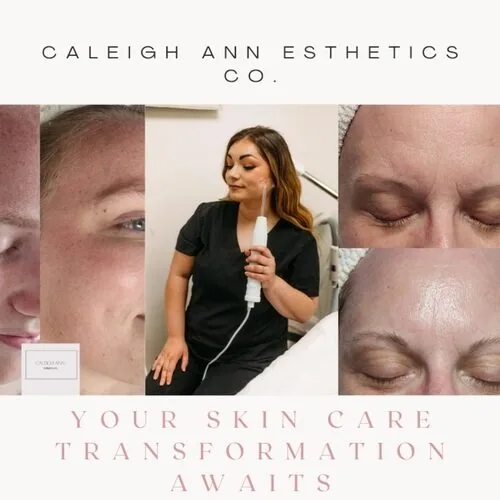 Caleigh Ann Esthetics CO photo