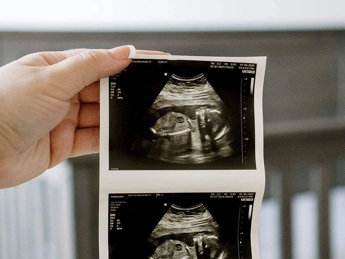 Nest Ultrasound Studio photo