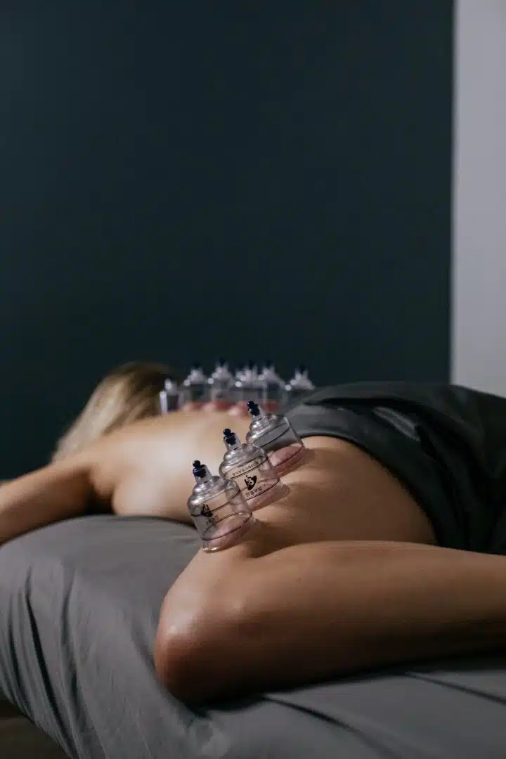 The Elm Massage Cupping